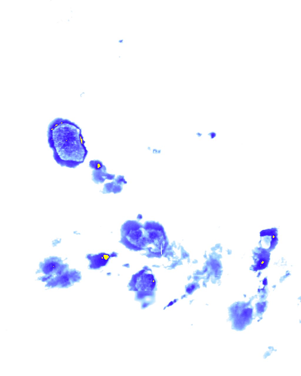 rainLayer